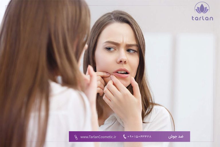 یک خانم که جوش صورت خود را فشار می‌دهد