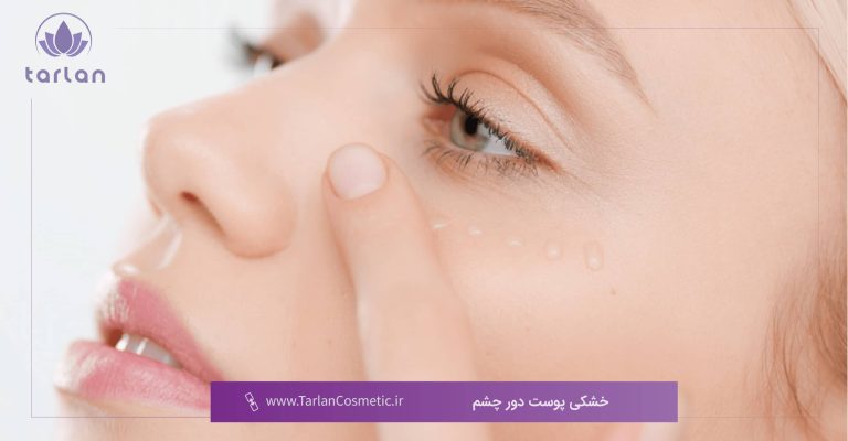 صورت یک خانم و اشاره به پوست دور چشم